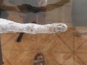 UN DETTAGLIO DEL DITO MUMMIFICATO DELLA STRANA MANO