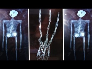 LA MINI-MUMMIA E LA MANO AI RAGGI X