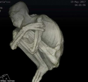 IL CORPO DI MARIA ALLO SCAN