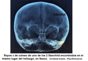 UNO DEI CRANI SIMILI ALLO STAR CHILD TROVATI NELLA GROTTA PERUVIANA