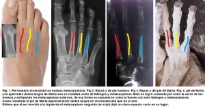 A CONFRONTO, UN PIEDE UMANO E UN PIEDE DI UNA MUMMIA- foto gentilmente concessa da Paul Ronceros