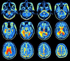 IL CERVELLO SI "ACCENDE" A SECONDA DEGLI STIMOLI RICEVUTI