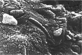 UN'IMMAGINE AL MICROSCOPIO A SCANSIONE ELETTRONICA